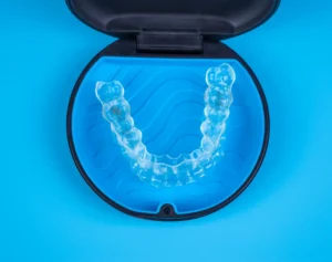 Der Retainer Arten, Kosten und Pflegetipps