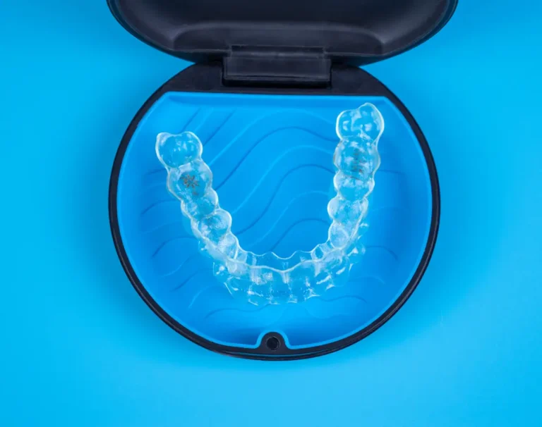 Der Retainer Arten, Kosten und Pflegetipps