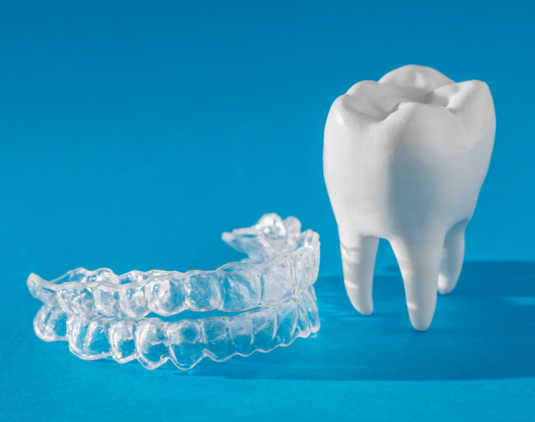 Invisalign oder feste Zahnspange