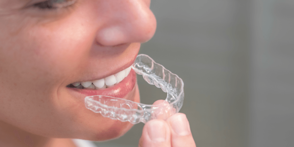 Invisalign