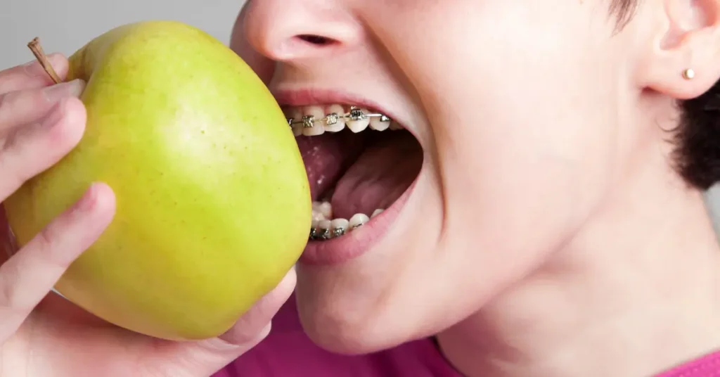 Ernährung mit Zahnspange